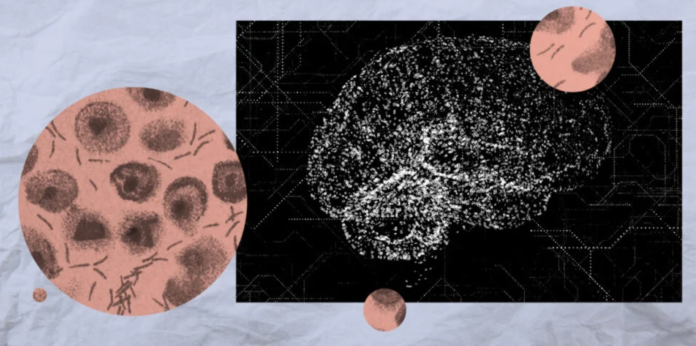 Detecting-Parkinson’s-Disease-Early