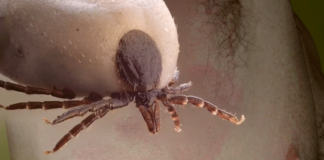 Lyme Disease: Symptoms, Causes, Treatment & Prevention Lyme-Disease