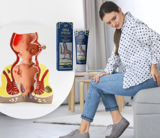 Sila Pchely ჰემოროიდის კრემი: ინგრედიენტები, ფასი და ონლაინ შეძენა Sila Pchely