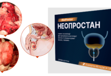 Капсули від неопростанового простатиту – природна формула підтримки простати з України NeoProstan-feature